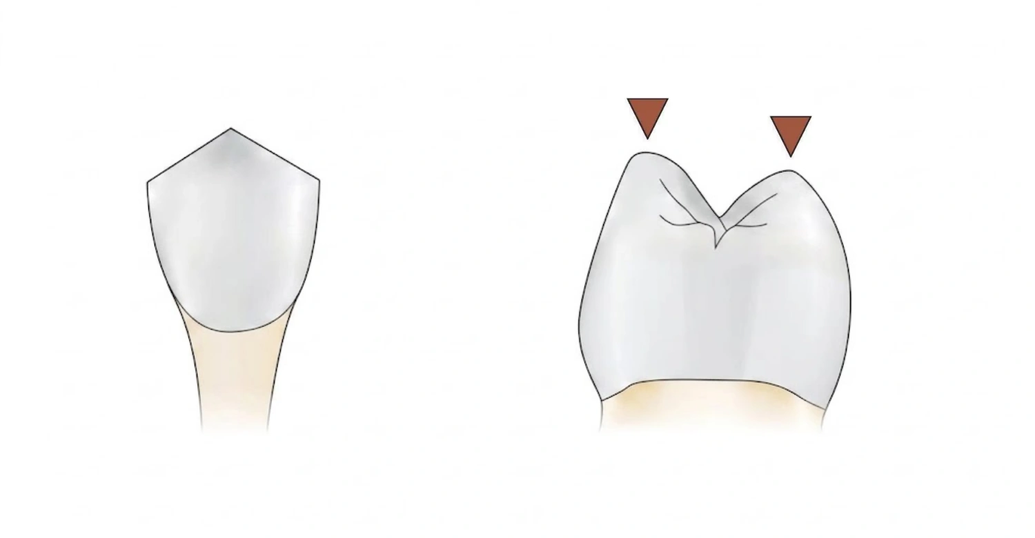 Tooth Cusps inblog